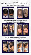 FEG Plus Hair Growth Spray 50ml | Anti-Hair Loss & Regrowth Solution