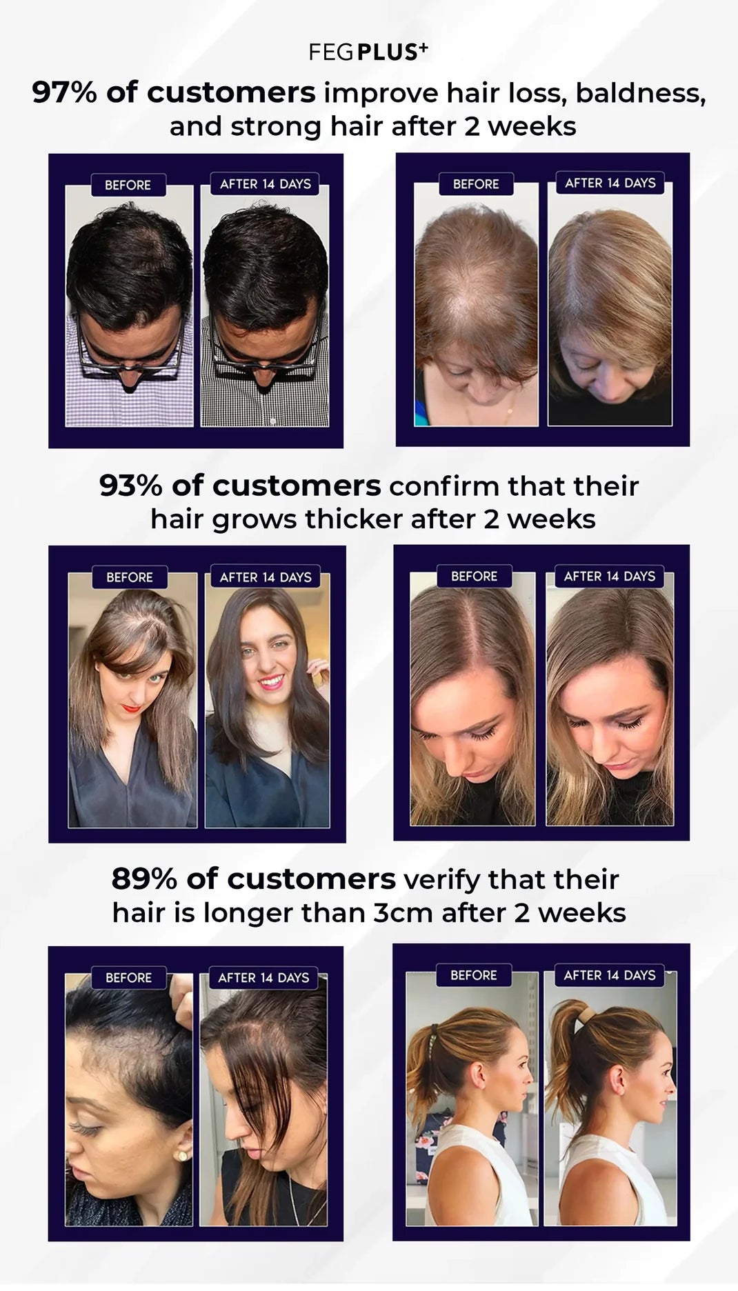 FEG Plus Hair Growth Spray 50ml | Anti-Hair Loss & Regrowth Solution