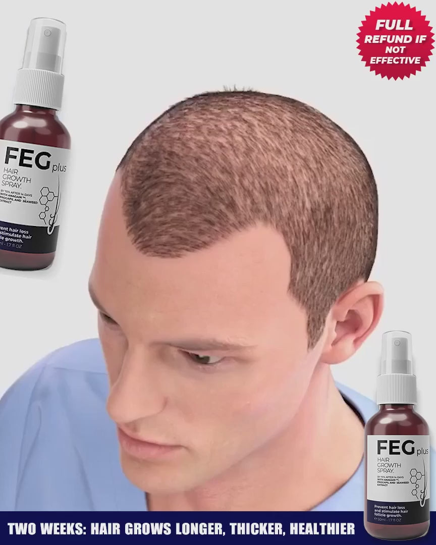FEG Plus Hair Growth Spray 50ml | Anti-Hair Loss & Regrowth Solution